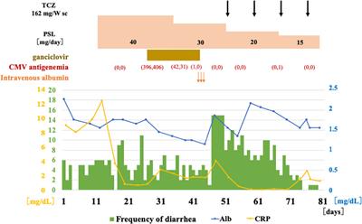 Case report: Rapid development of amyloid A amyloidosis in temporal arteritis with SAA1.3 allele; An unusual case of intestinal amyloidosis secondary to temporal arteritis